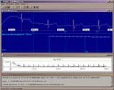 EKG-Auswertung